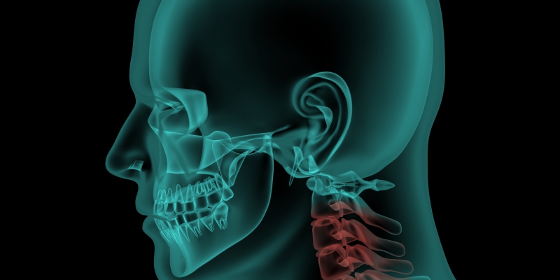OCLUSIÓN, POSTURA, CONTROL MOTOR, DOLOR Y SUS RELACIONES CON LA DISFUNCIÓN MANDIBULAR